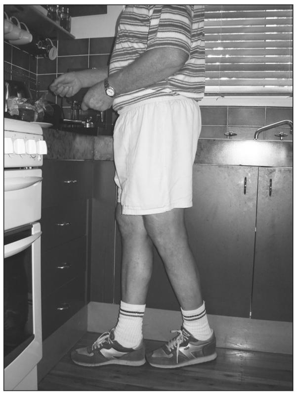 A black and white photograph of a man standing in a kitchen. He has one foot in front of the other and is wearing shorts and a striped shirt.