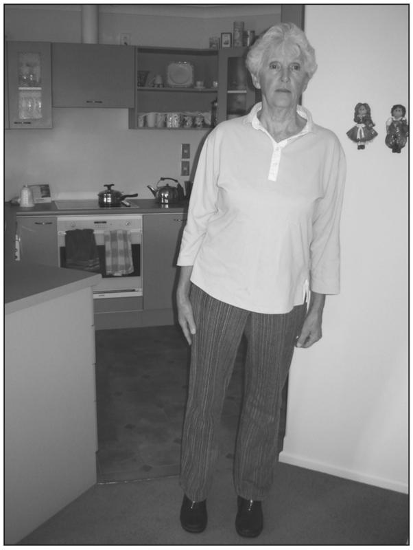 A black and white photograph of an elderly woman standing in a kitchen with her feet apart and her arms resting by her sides. She is leaning heavily on her left foot.