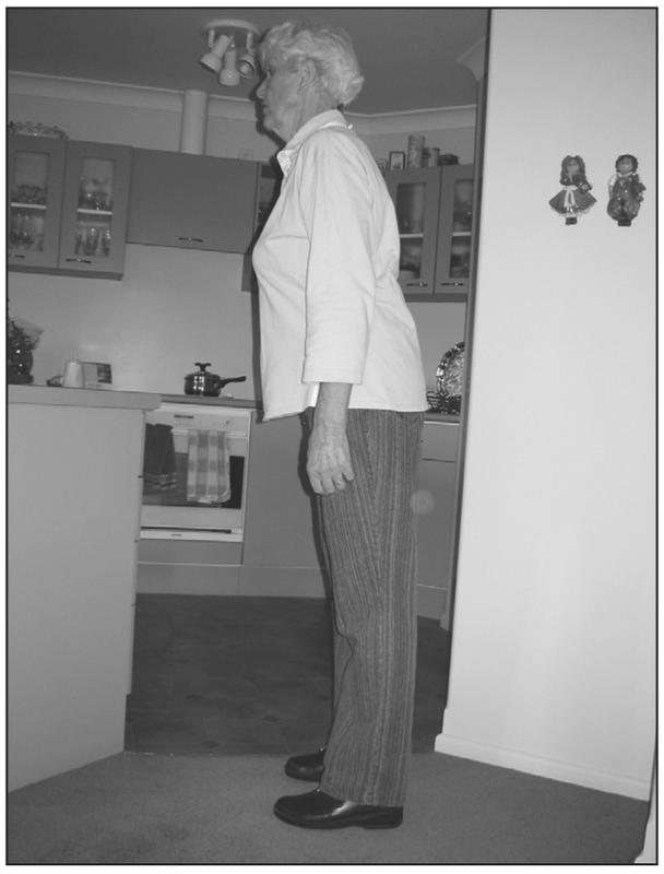 A black and white photograph of an elderly woman leaning slightly forward with heels on the ground. 