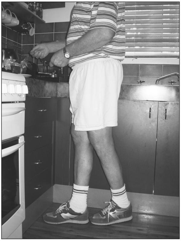 A black and white photograph of a man standing in a kitchen. He has one foot in front of the other and is wearing shorts and a striped shirt. The heel of his back foot is slightly raised.