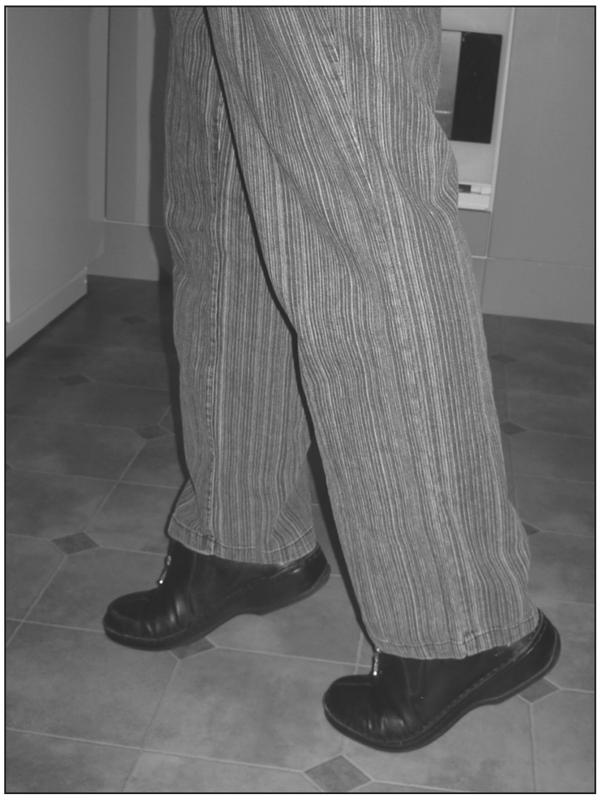 A black and white photograph of an elderly person walking on their toes.