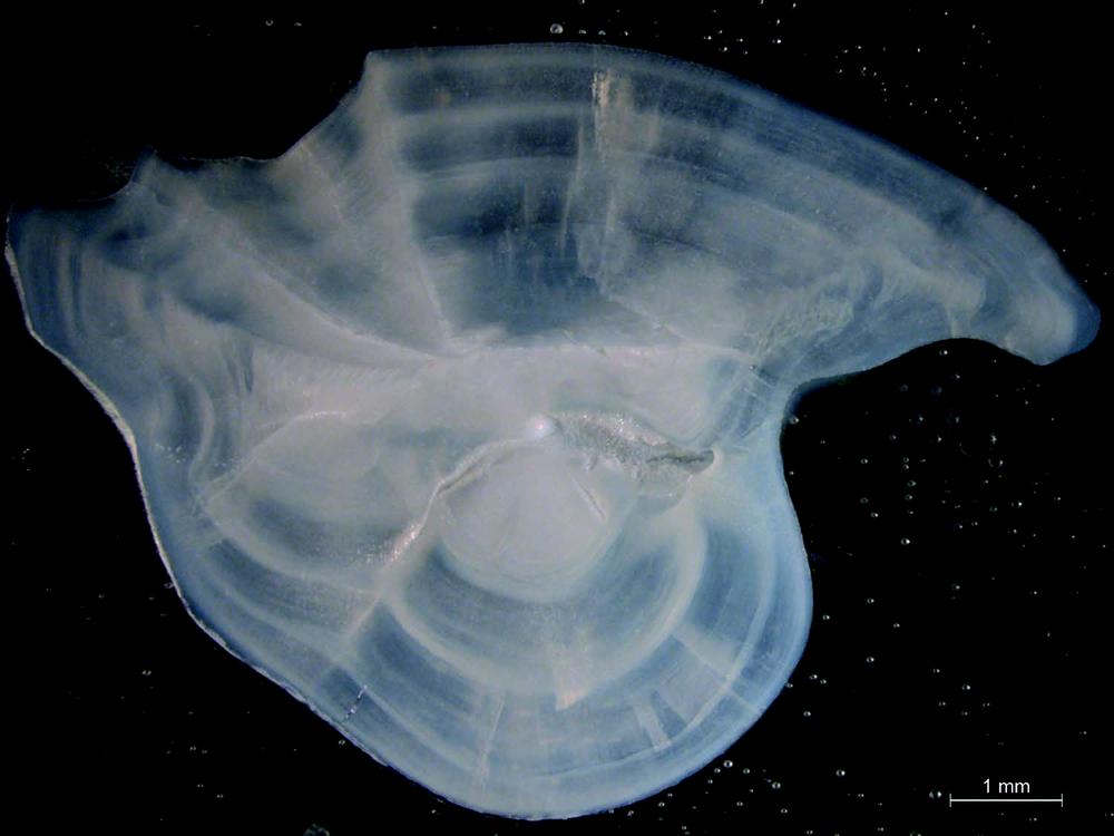 Photograph of a white, partially translucent shape on a black background. A scale bar is positioned on the right for measurement.