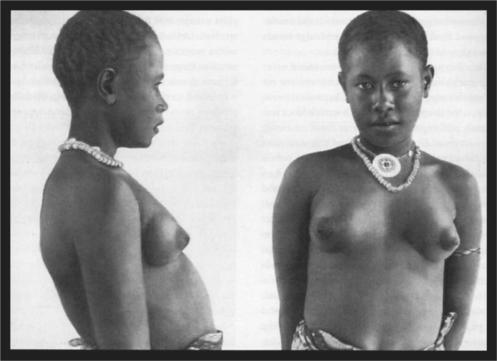 Black and white image of a girl from Northern Island with a front on and profile view.