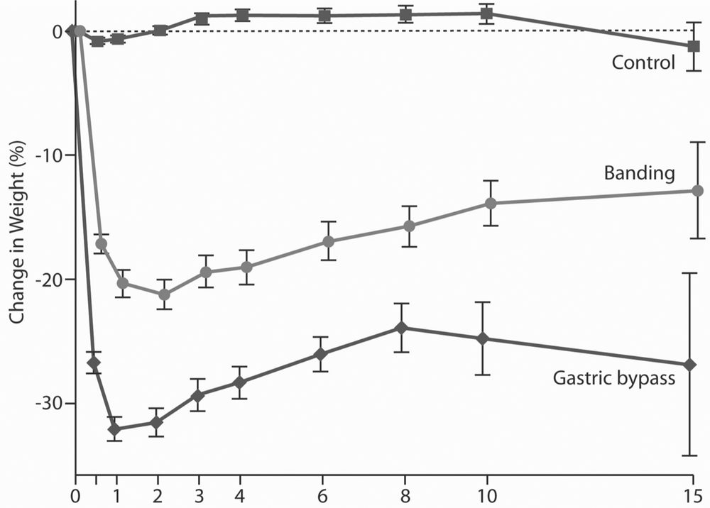 A line graph showing the changing weight for two surgeries, compared to a relatively stable weight control line at the top of the graph. The banding has a significant drop in weight and then a stabilising. The gastric bypass has an even bigger drop in weight, followed by a small increase before stabilising.
